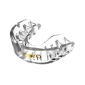 Gebitsbeschermer Opro  Gold Clear Senior